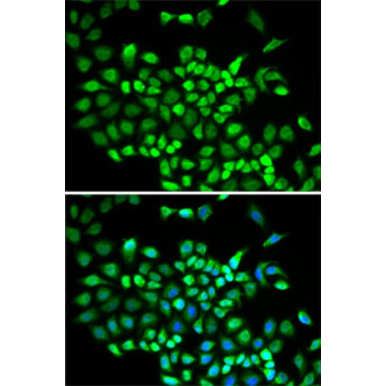 Immunofluorescence - Anti-Cullin 2/CUL-2 Antibody (A14656) - Antibodies.com