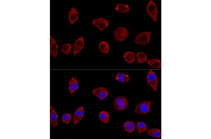 Immunofluorescence - Anti-D Amino Acid Oxidase Antibody (A14657) - Antibodies.com