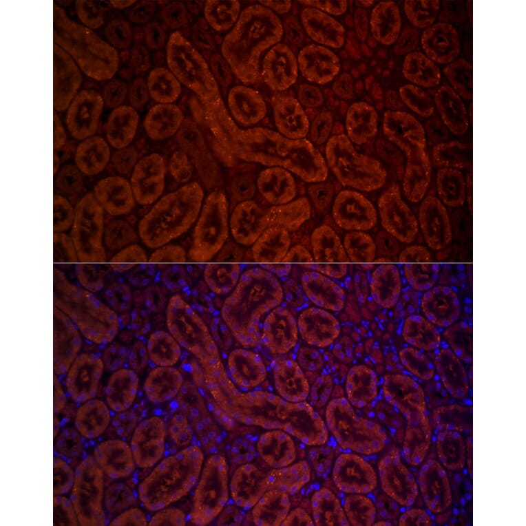 Immunofluorescence - Anti-D Amino Acid Oxidase Antibody (A14657) - Antibodies.com