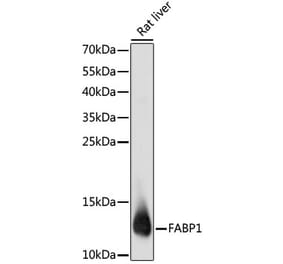 Western Blot - Anti-liver FABP Antibody (A14658) - Antibodies.com