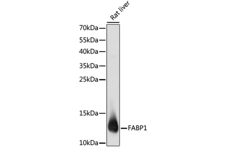 Western Blot - Anti-liver FABP Antibody (A14658) - Antibodies.com