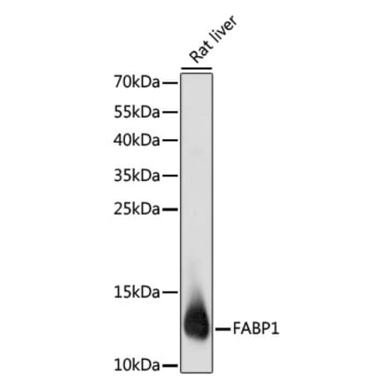 Western Blot - Anti-liver FABP Antibody (A14658) - Antibodies.com