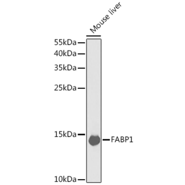 Western Blot - Anti-liver FABP Antibody (A14658) - Antibodies.com