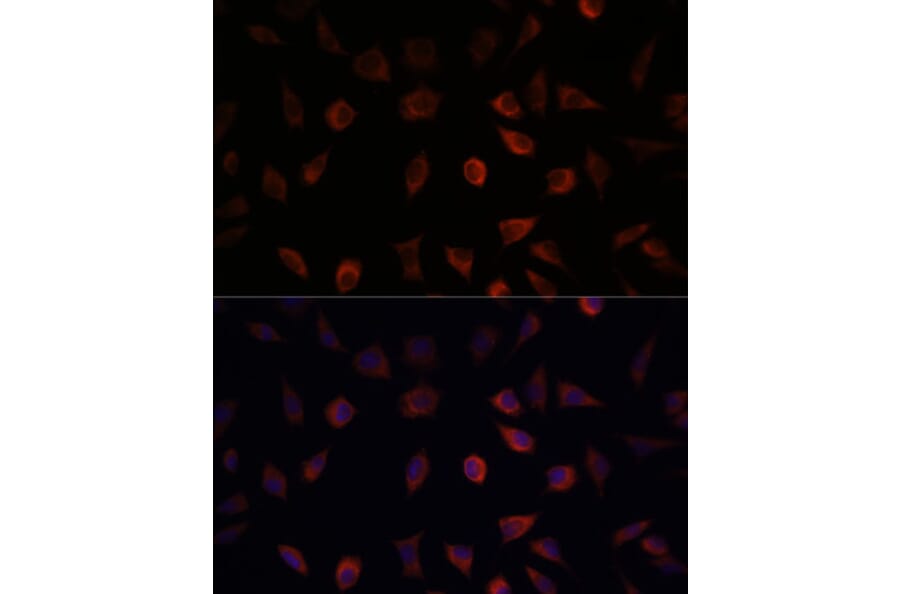 Immunofluorescence - Anti-liver FABP Antibody (A14658) - Antibodies.com
