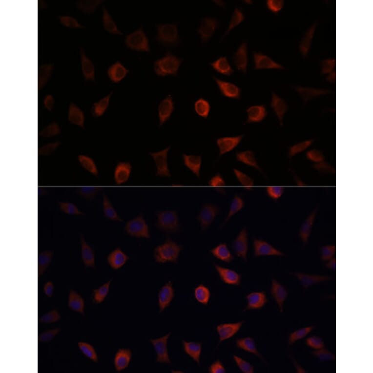 Immunofluorescence - Anti-liver FABP Antibody (A14658) - Antibodies.com