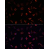 Immunofluorescence - Anti-liver FABP Antibody (A14658) - Antibodies.com