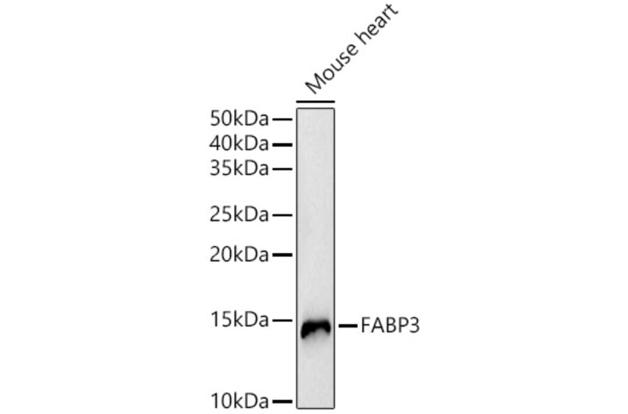 Western Blot - Anti-H-FABP Antibody (A14659) - Antibodies.com