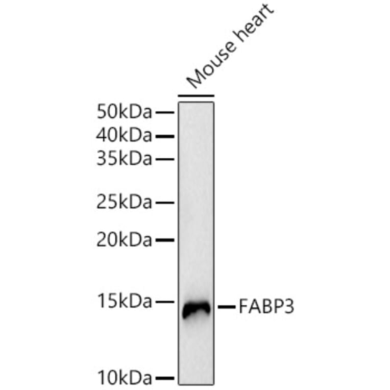 Western Blot - Anti-H-FABP Antibody (A14659) - Antibodies.com