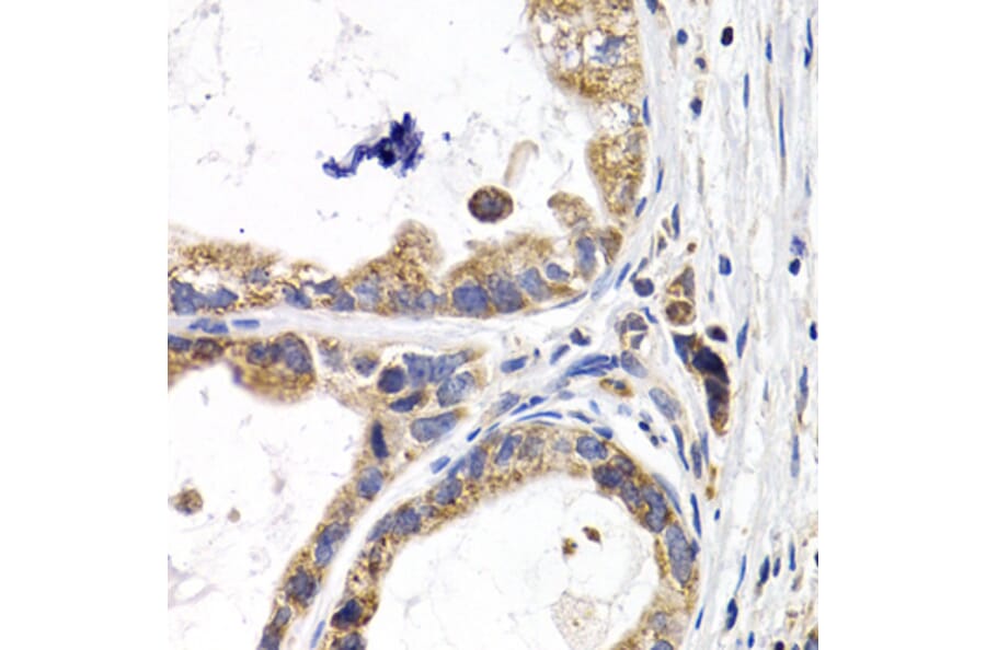 Immunohistochemistry - Anti-H-FABP Antibody (A14659) - Antibodies.com