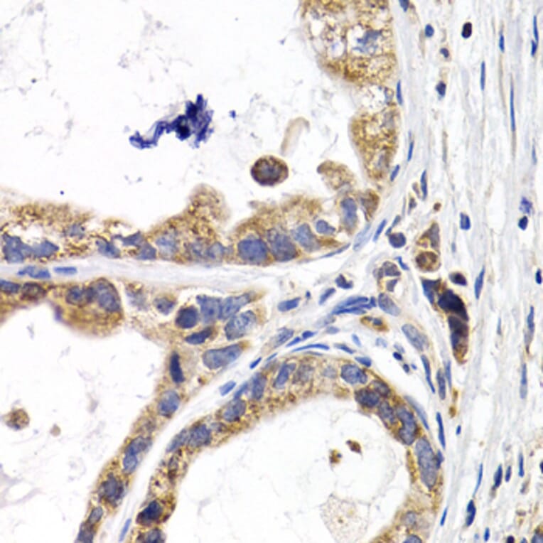 Immunohistochemistry - Anti-H-FABP Antibody (A14659) - Antibodies.com