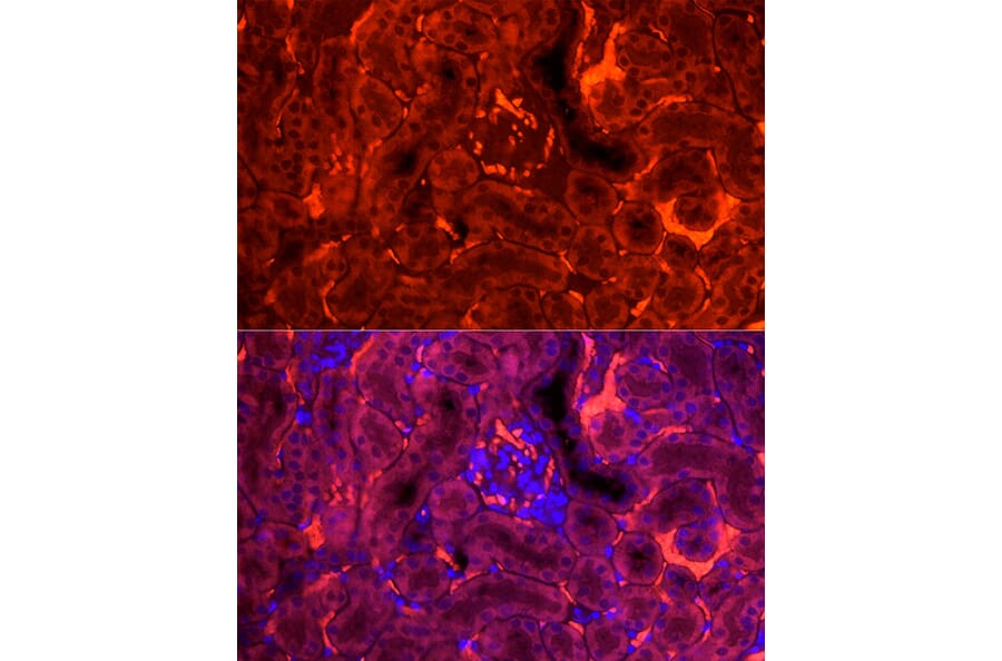 Immunofluorescence - Anti-H-FABP Antibody (A14659) - Antibodies.com