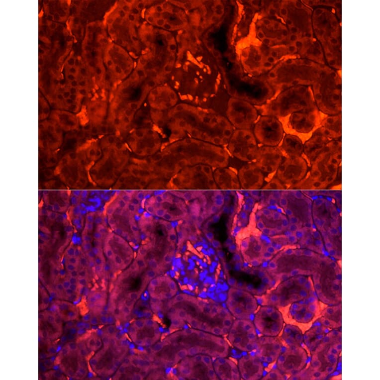 Anti-H-FABP Antibody (A14659) | Antibodies.com