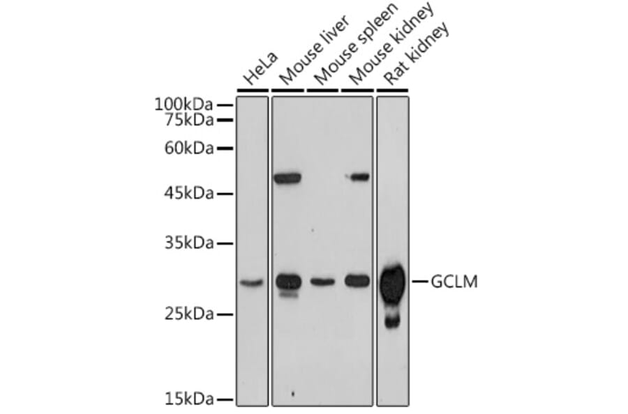 Western Blot - Anti-GCLM Antibody (A14661) - Antibodies.com