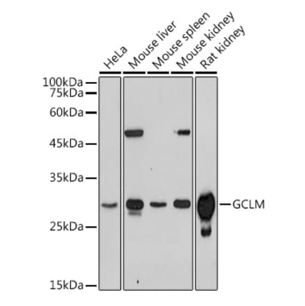 Western Blot - Anti-GCLM Antibody (A14661) - Antibodies.com