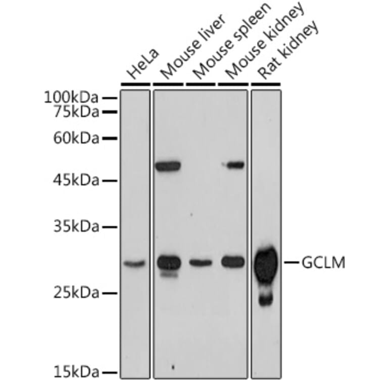 Western Blot - Anti-GCLM Antibody (A14661) - Antibodies.com