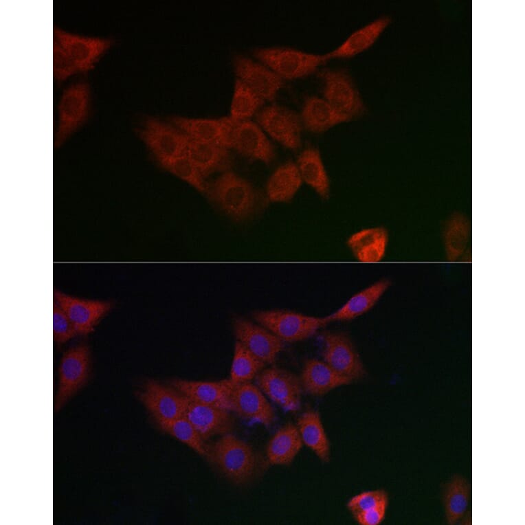 Immunofluorescence - Anti-GCLM Antibody (A14661) - Antibodies.com