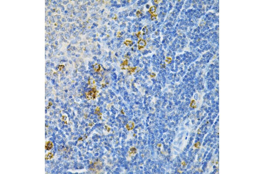 Immunohistochemistry - Anti-Glutaredoxin 1 Antibody (A14662) - Antibodies.com