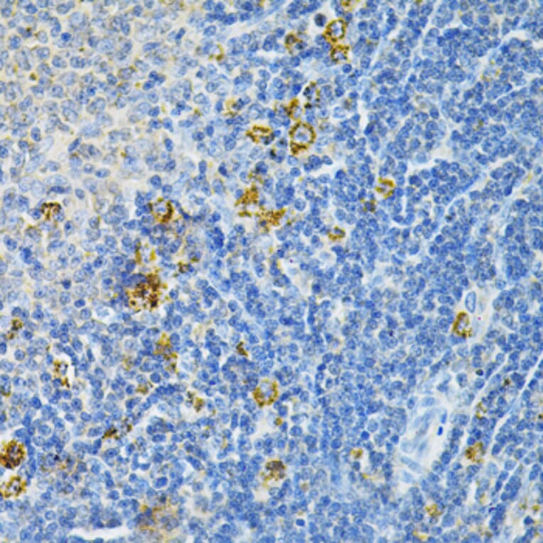 Immunohistochemistry - Anti-Glutaredoxin 1 Antibody (A14662) - Antibodies.com