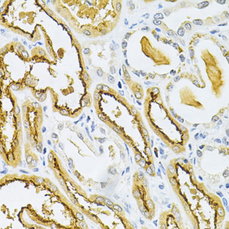 Immunohistochemistry - Anti-Glutaredoxin 1 Antibody (A14662) - Antibodies.com