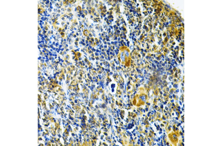 Immunohistochemistry - Anti-Glutaredoxin 1 Antibody (A14662) - Antibodies.com