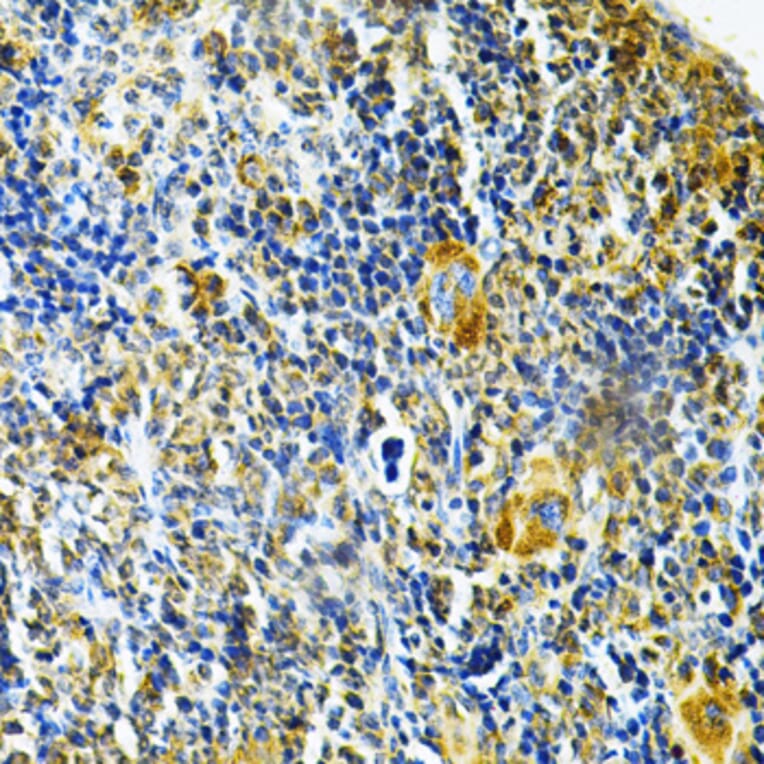 Immunohistochemistry - Anti-Glutaredoxin 1 Antibody (A14662) - Antibodies.com