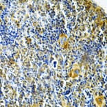 Immunohistochemistry - Anti-Glutaredoxin 1 Antibody (A14662) - Antibodies.com