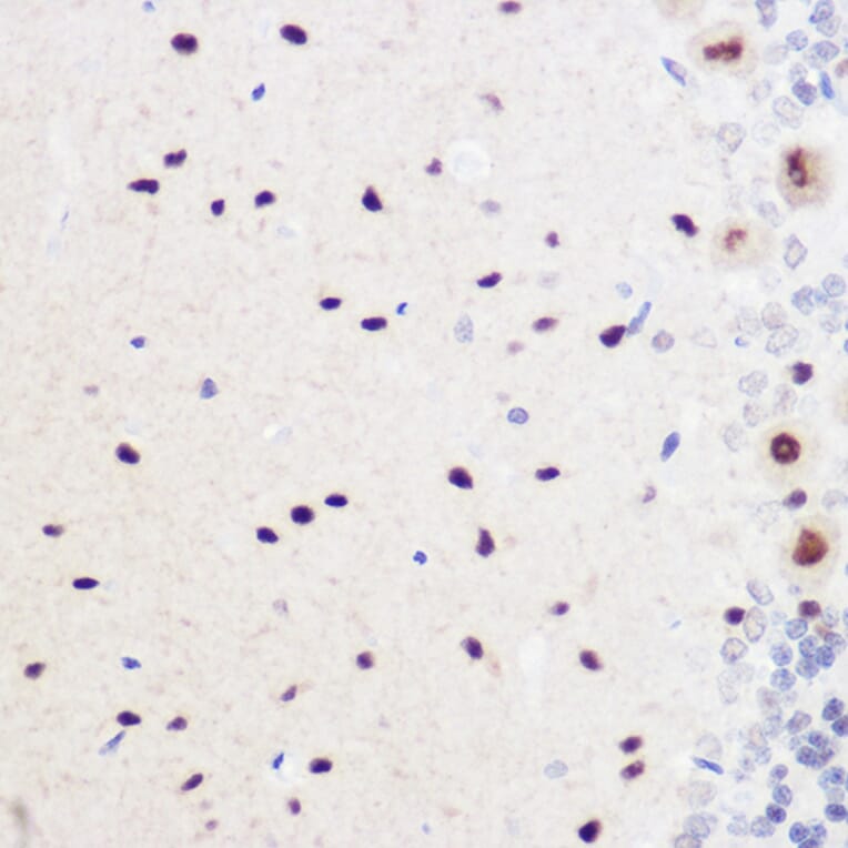 Immunohistochemistry - Anti-Geminin Antibody (A14663) - Antibodies.com