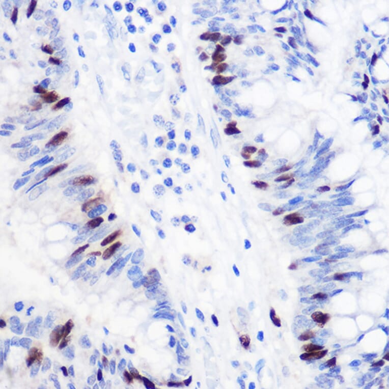 Immunohistochemistry - Anti-Geminin Antibody (A14663) - Antibodies.com