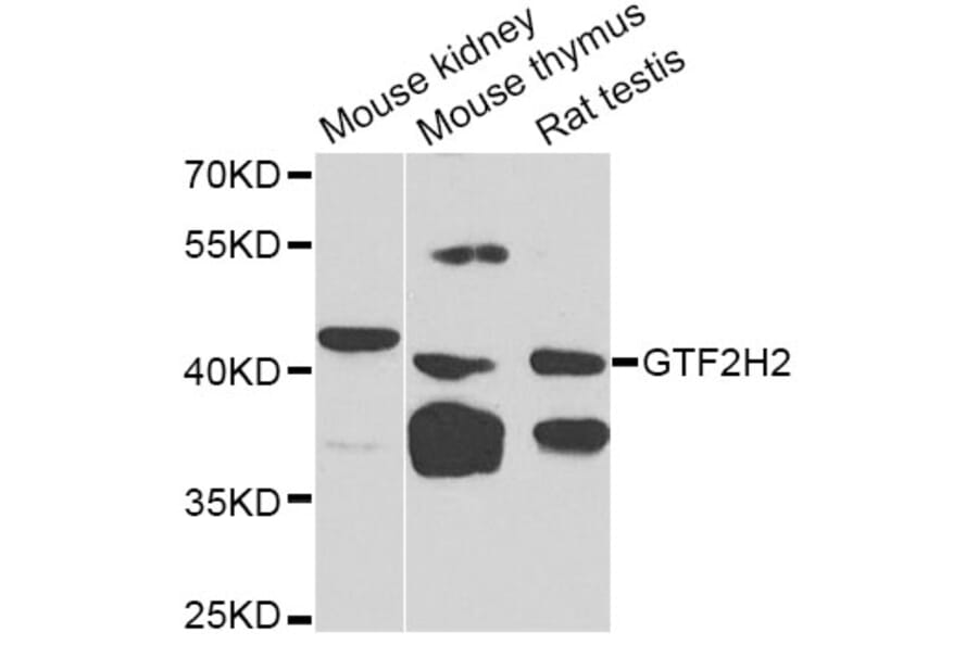 Western Blot - Anti-GTF2H2 Antibody (A5317) - Antibodies.com