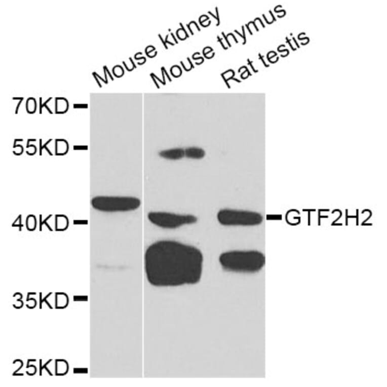 Western Blot - Anti-GTF2H2 Antibody (A5317) - Antibodies.com