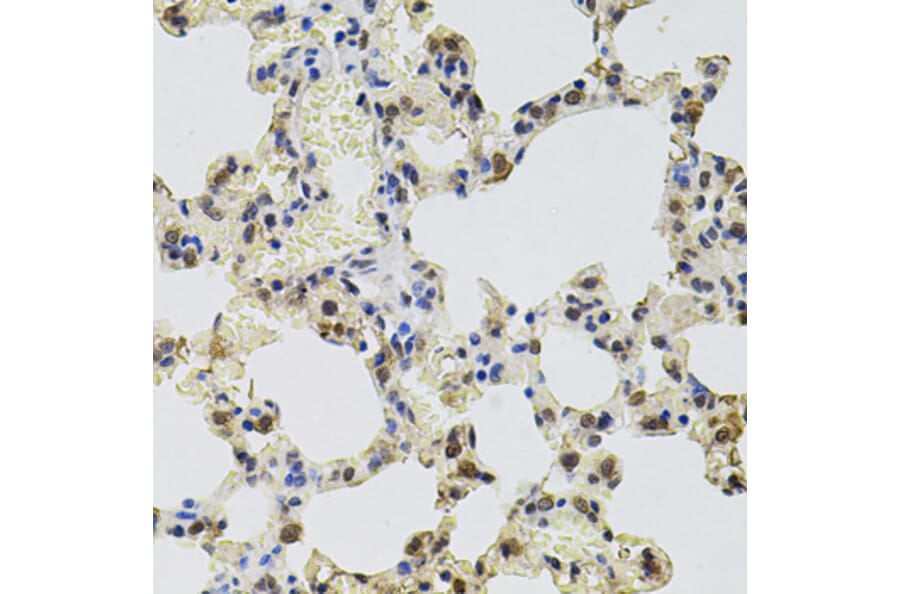 Immunohistochemistry - Anti-GTF2H2 Antibody (A5317) - Antibodies.com
