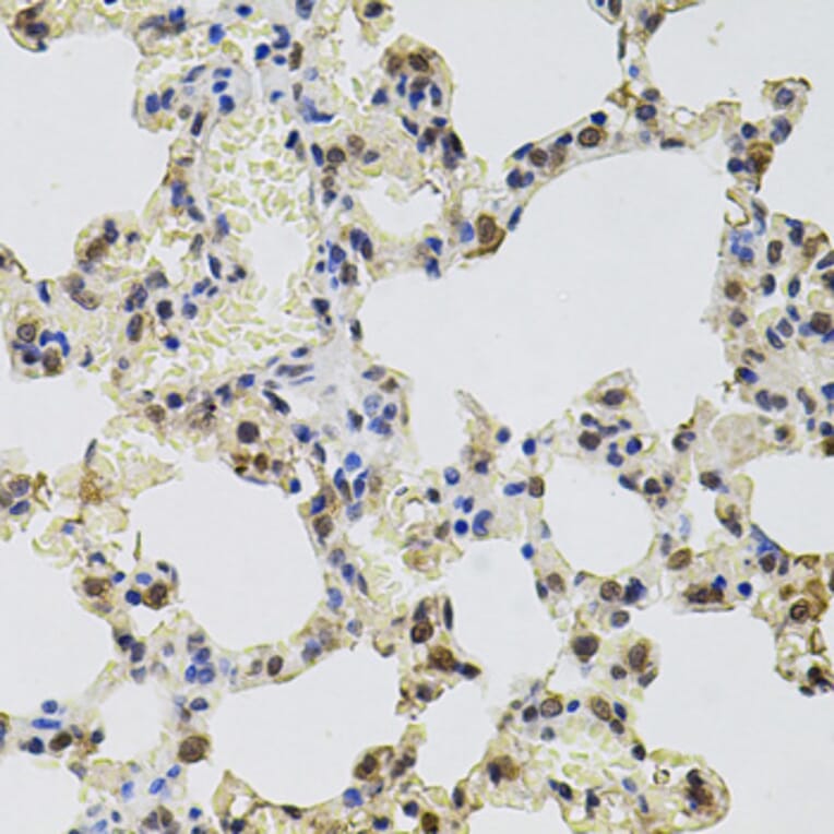 Immunohistochemistry - Anti-GTF2H2 Antibody (A5317) - Antibodies.com