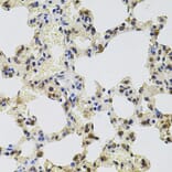 Immunohistochemistry - Anti-GTF2H2 Antibody (A5317) - Antibodies.com