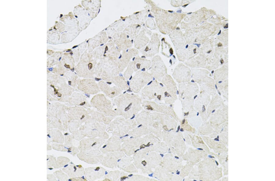 Immunohistochemistry - Anti-GTF2H2 Antibody (A5317) - Antibodies.com