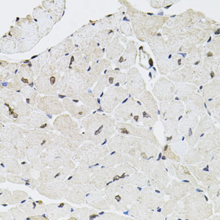 Immunohistochemistry - Anti-GTF2H2 Antibody (A5317) - Antibodies.com