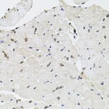 Immunohistochemistry - Anti-GTF2H2 Antibody (A5317) - Antibodies.com