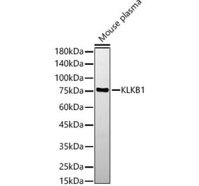 Western Blot - Anti-Plasma Kallikrein 1B Antibody (A14665) - Antibodies.com
