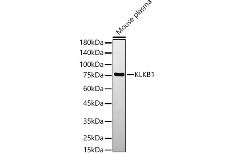 Western Blot - Anti-Plasma Kallikrein 1B Antibody (A14665) - Antibodies.com