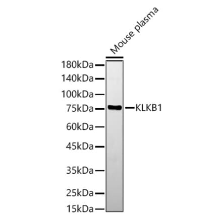 Western Blot - Anti-Plasma Kallikrein 1B Antibody (A14665) - Antibodies.com