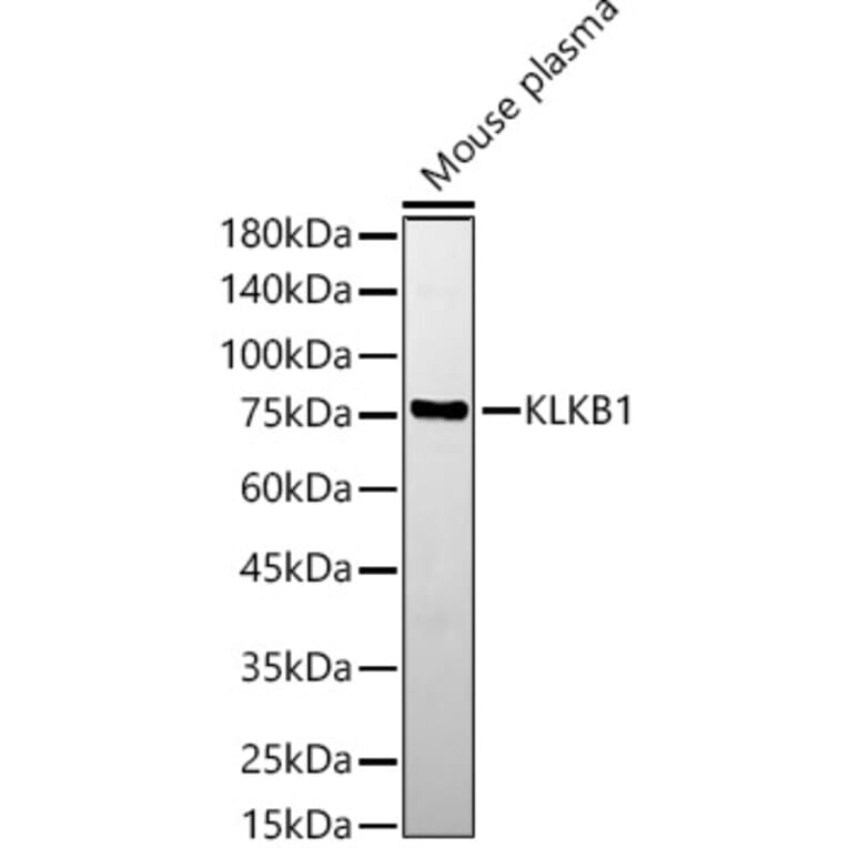Western Blot - Anti-Plasma Kallikrein 1B Antibody (A14665) - Antibodies.com