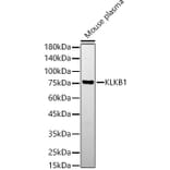 Western Blot - Anti-Plasma Kallikrein 1B Antibody (A14665) - Antibodies.com