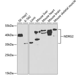Western Blot - Anti-NDRG2 Antibody (A14666) - Antibodies.com