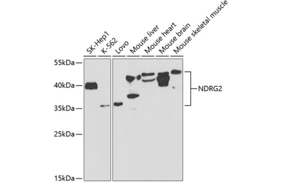 Western Blot - Anti-NDRG2 Antibody (A14666) - Antibodies.com