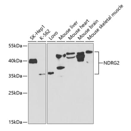 Western Blot - Anti-NDRG2 Antibody (A14666) - Antibodies.com