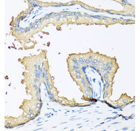 Immunohistochemistry - Anti-NOV Antibody (A14667) - Antibodies.com