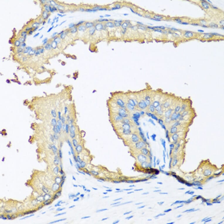 Immunohistochemistry - Anti-NOV Antibody (A5320) - Antibodies.com