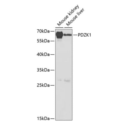 Western Blot - Anti-PDZK1 Antibody (A14668) - Antibodies.com