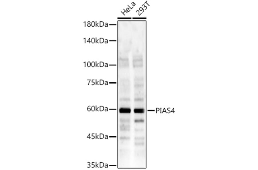 Western Blot - Anti-E3 SUMO-protein ligase PIAS4/PIASy Antibody (A14669) - Antibodies.com