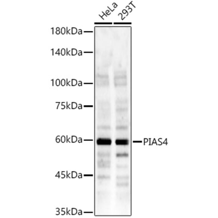 Western Blot - Anti-E3 SUMO-protein ligase PIAS4/PIASy Antibody (A14669) - Antibodies.com