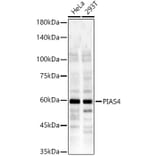 Western Blot - Anti-E3 SUMO-protein ligase PIAS4/PIASy Antibody (A14669) - Antibodies.com